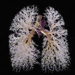 lung-bronchi.jpeg